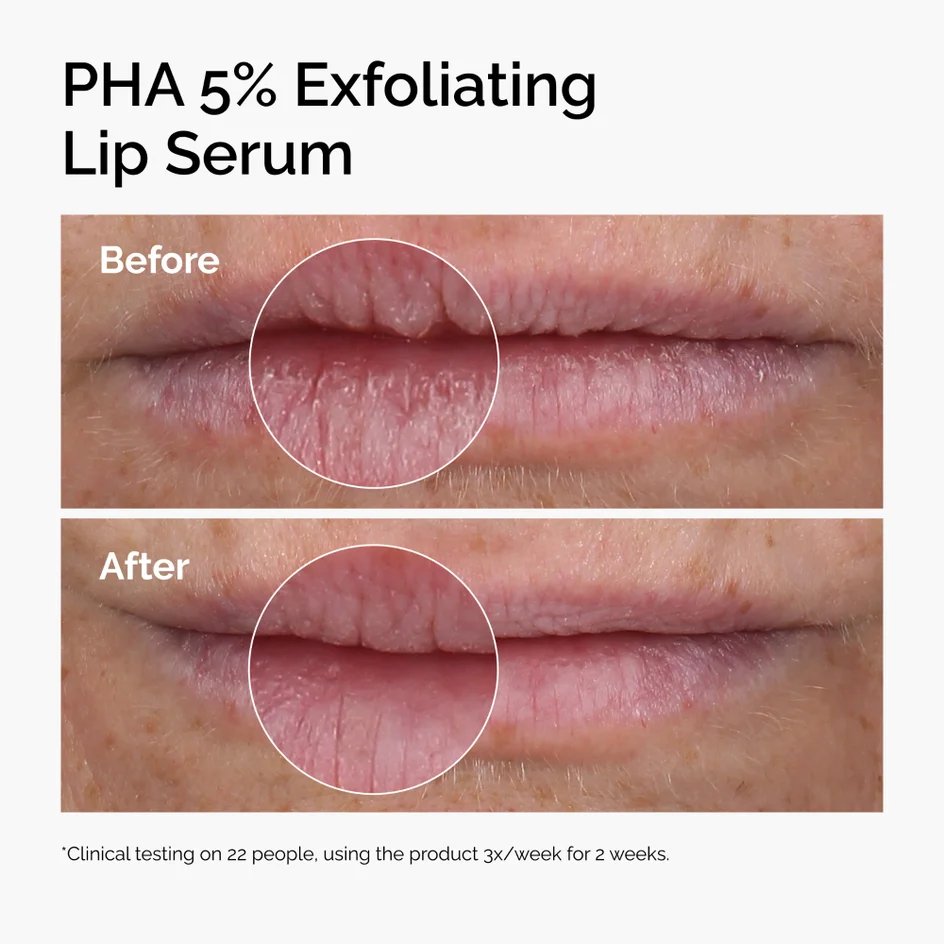 The OrdinaryPHA 5% Exfoliating Lip Serum 15ml